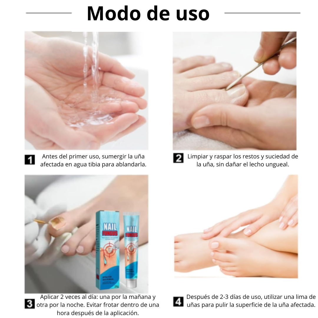 🧴 Nail Fungus® | Pomada para Uñas (Onicomicosis)