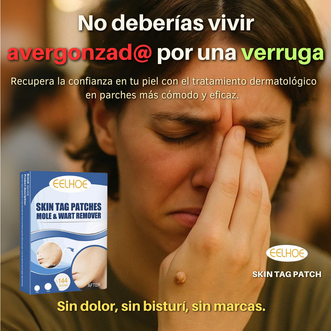 EELHOE PRO™   – Eliminación de Verrugas sin Dolor (144 Parches)