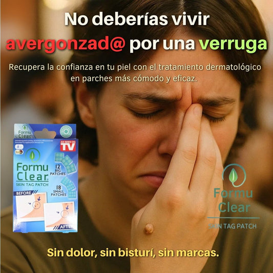 FormuClear PRO – Eliminación de Verrugas sin Dolor